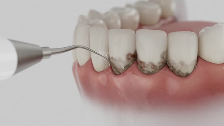 Reliable Tooth Extraction contractor in Meeker County County, MN by Dentist Open Now